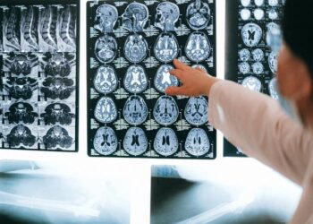Menos de 30 minutos de actividad física diaria puede mejorar tu cerebro