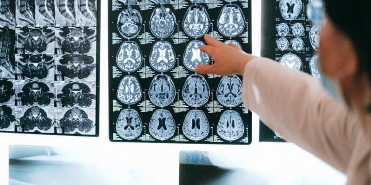 Menos de 30 minutos de actividad física diaria puede mejorar tu cerebro