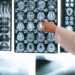 Menos de 30 minutos de actividad física diaria puede mejorar tu cerebro
